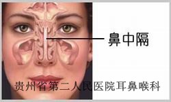 鼻中隔偏曲患者有哪些症状