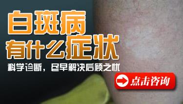 发展期白癜风有什么症状