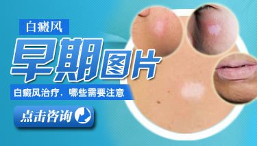 白癜风早期出现这些症状
