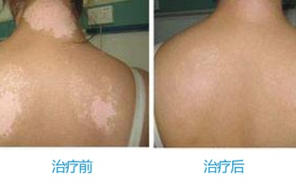 �人����������֢״