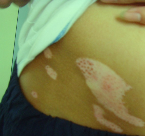 �����Ԥ��Ӧ����Щ��������