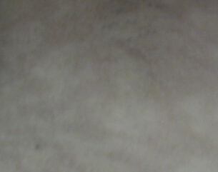 ��ͯ��������֢״
