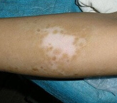 �人��õİ���ҽԺ���ļ�