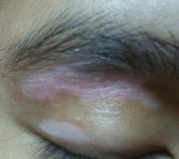 �人��������õ�ҽԺ���ļ�