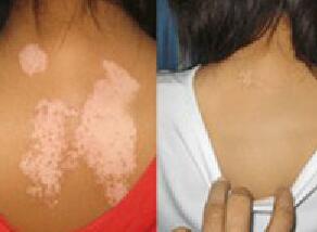 �人�����ļ�Ԥ���ķ�ʽ