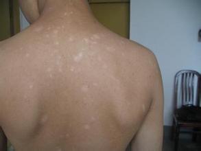 �ļ������ЧԤ�����磿�人��ð���ҽԺ��