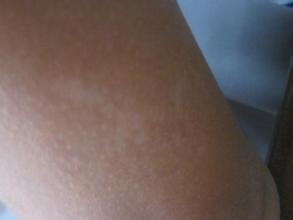 �人��������ƹ�����������Ӧע����Щ��