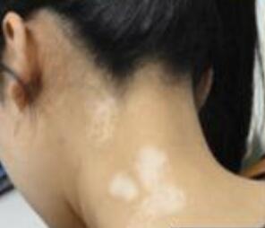 �人���������Σ�����ɹ̫���Ƿ����������ư���