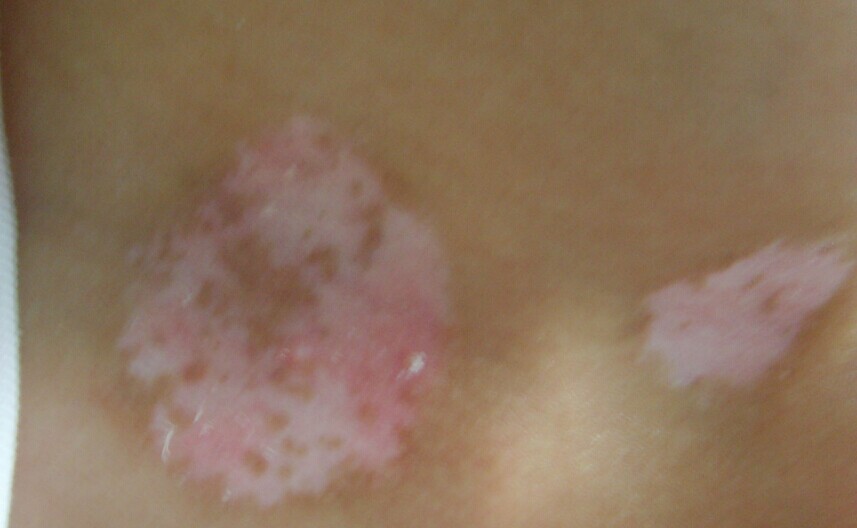 �ΰ����人�ǼҺã������ſ���Ԥ��������ɢ��