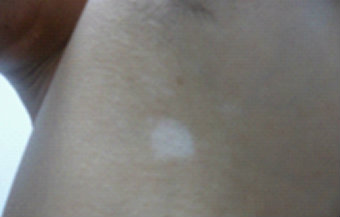 �人�ΰ���ҽԺ�ļҺã�����ķ���ԭ����֪�����٣�