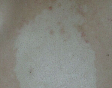 �人ר�����粡��ҽԺ������Ԥ���뱣��