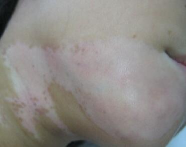 �人���ưװ�ҽԺ������ķ�����Ҫ��ʲô