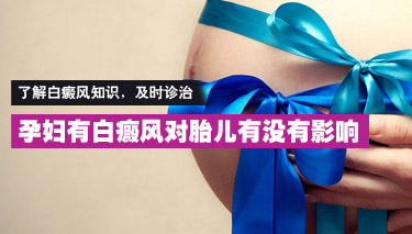 孕妇白癜风患者的日常护理需要注意哪些